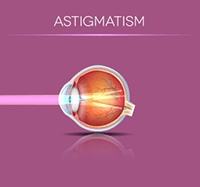 Astigmatism Astigmatism