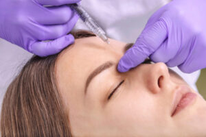 woman receiving botox shot 