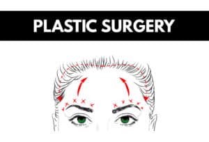 Plastic Surgery